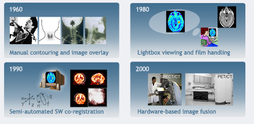 History of hybrid Imaging